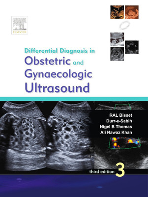 Differential Diagnosis in Obstetric and Gynaecologic Ultrasound(English, Paperback, Bisset R. A. L.)
