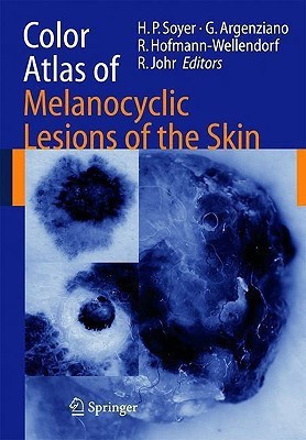Color Atlas of Melanocytic Lesions of the Skin(English, Hardcover, unknown)
