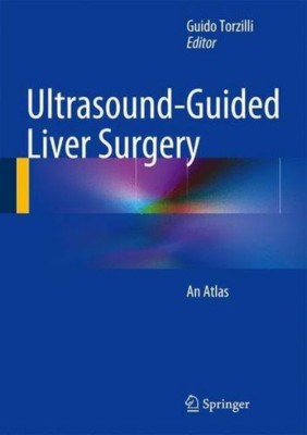 Ultrasound-Guided Liver Surgery(English, Hardcover, unknown)