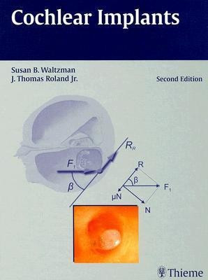 Cochlear Implants(English, Hardcover, Waltzman Susan B Jr.)