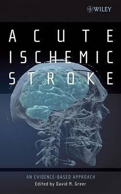 Acute Ischemic Stroke(English, Electronic book text, unknown)