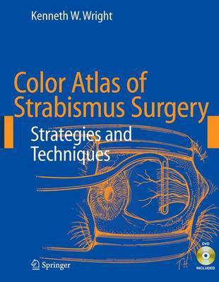 Color Atlas of Strabismus Surgery(English, Electronic book text, Wright Kenneth W)