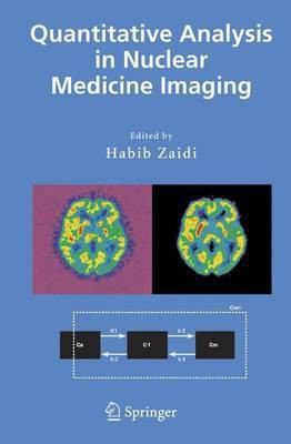 Quantitative Analysis in Nuclear Medicine Imaging(English, Electronic book text, unknown)