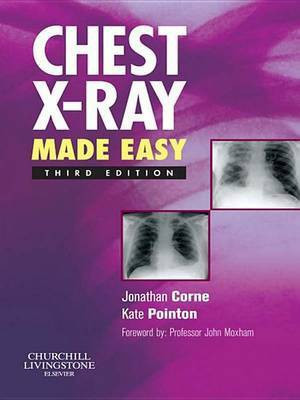 Chest X-Ray Made Easy E-Book(English, Electronic book text, MRCP Frcr Corne Jonathan)