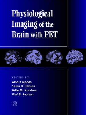 Physiological Imaging of the Brain with PET(English, Hardcover, unknown)