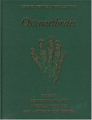 Osteoarthritis(English, Hardcover, Brandt Kenneth)