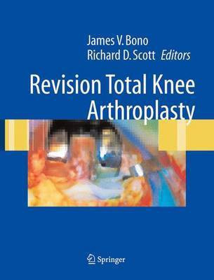 Revision Total Knee Arthroplasty(English, Electronic book text, Bono James V)