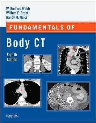 Fundamentals of Body CT E-Book(English, Electronic book text, Webb W Richard M.D.)