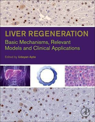 Liver Regeneration(English, Electronic book text, unknown)
