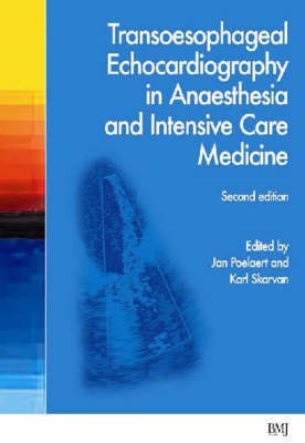 Transoesophageal Echocardiography in Anaesthesia and Intensive Care Medicine 2nd  Edition(English, Hardcover, unknown)