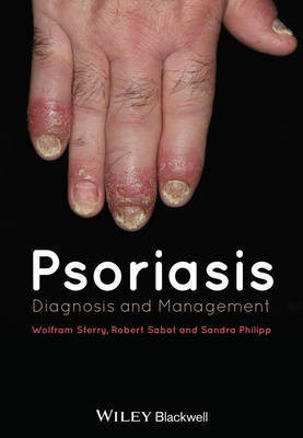Psoriasis(English, Hardcover, unknown)