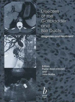 Diseases of the Gallbladder and Bile Ducts(English, Hardcover, unknown)