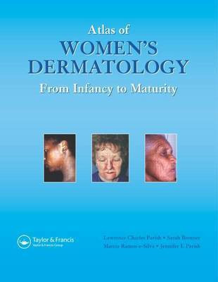 Atlas of Women's Dermatology(English, Electronic book text, Parish MD Lawrence Charles)