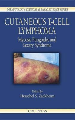 Cutaneous T-Cell Lymphoma(English, Electronic book text, unknown)