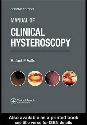Manual of Clinical Hysteroscopy, Second Edition(English, Electronic book text, Valle Rafael F.)