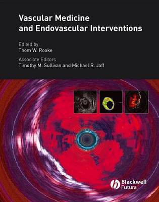 Vascular Medicine and Endovascular Interventions(English, Electronic book text, unknown)