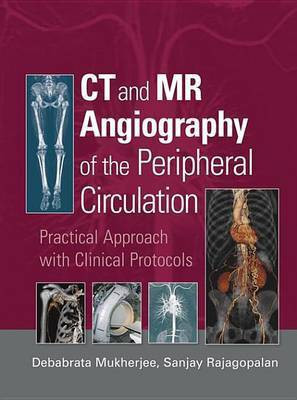 CT and MR Angiography of the Peripheral Circulation(English, Electronic book text, unknown)