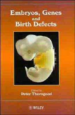 Embryos, Genes and Birth Defects(English, Paperback, unknown)