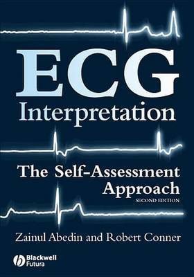 ECG Interpretation(English, Electronic book text, Abedin Zainul)