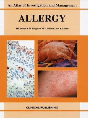 Allergy(English, Electronic book text, unknown)