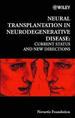 Neural Transplantation in Neurodegenerative Disease(English, Electronic book text, unknown)