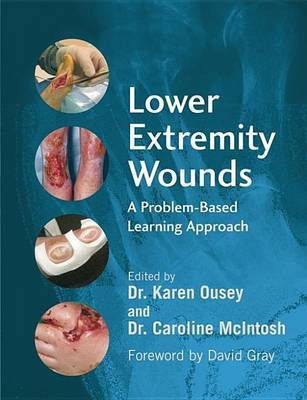 Lower Extremity Wounds(English, Electronic book text, unknown)