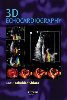 3D Echocardiography(English, Electronic book text, unknown)