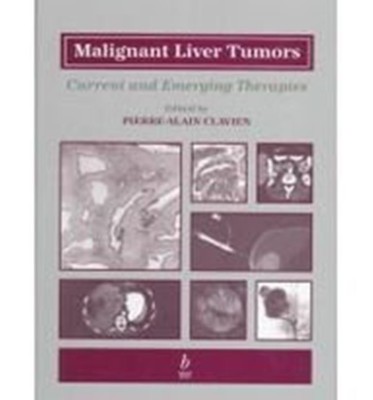 Malignant Liver Tumors(English, Hardcover, unknown)