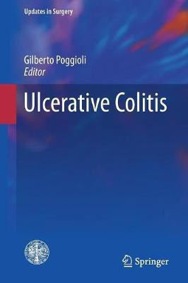 Ulcerative Colitis(English, Paperback, unknown)