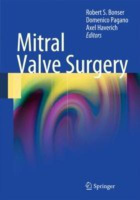 Mitral Valve Surgery(English, Hardcover, unknown)