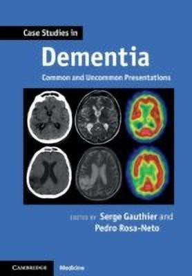 Case Studies in Dementia: Volume 1(English, Paperback, unknown)