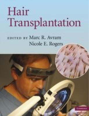 Hair Transplantation(English, Hardcover, Avram Marc R.)