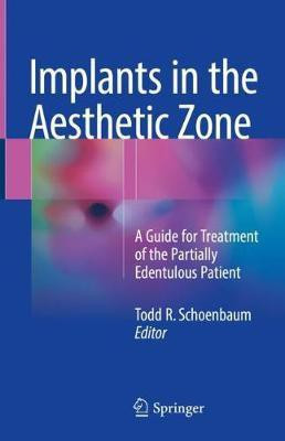 Implants in the Aesthetic Zone(English, Hardcover, unknown)