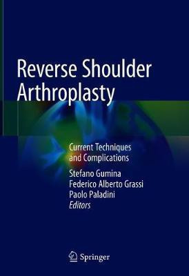 Reverse Shoulder Arthroplasty(English, Hardcover, unknown)