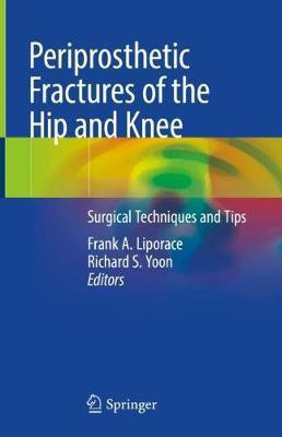 Periprosthetic Fractures of the Hip and Knee(English, Hardcover, unknown)