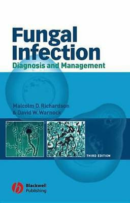 Fungal Infection(English, Electronic book text, Richardson Malcolm D.)