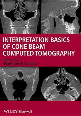 Interpretation Basics of Cone Beam Computed Tomography(English, Electronic book text, Gonzalez Shawneen M.)