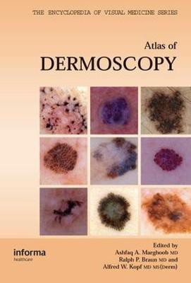 An Atlas of Dermoscopy(English, Mixed media product, unknown)