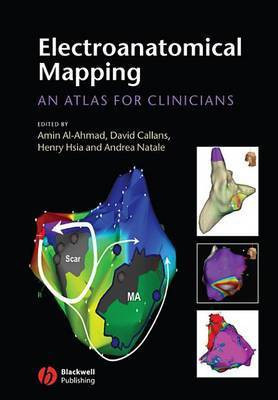 Electroanatomical Mapping(English, Electronic book text, unknown)