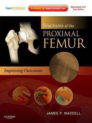 Fractures of the Proximal Femur: Improving Outcomes E-Book(English, Electronic book text, Waddell James P)