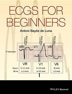 ECGs for Beginners(English, Electronic book text, Bayes de Luna Antoni)