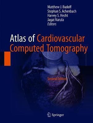 Atlas of Cardiovascular Computed Tomography(English, Hardcover, unknown)