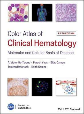 Color Atlas of Clinical Hematology(English, Hardcover, Hoffbrand A. Victor)
