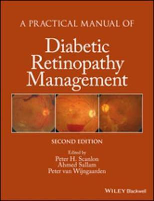 A Practical Manual of Diabetic Retinopathy Management(English, Electronic book text, unknown)