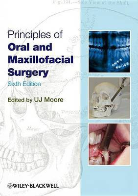 Principles of Oral and Maxillofacial Surgery(English, Electronic book text, Moore U. J.)
