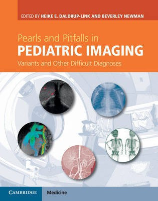 Pearls and Pitfalls in Pediatric Imaging(English, Hardcover, unknown)