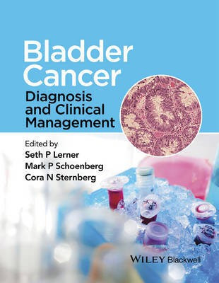 Bladder Cancer(English, Hardcover, unknown)