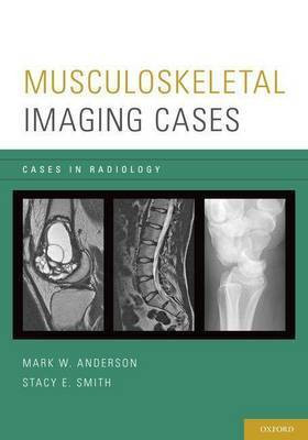 Musculoskeletal Imaging Cases(English, Electronic book text, Section Head, Anderson Mark W)