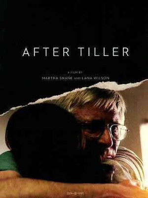 

AFTER TILLER(DVD English)