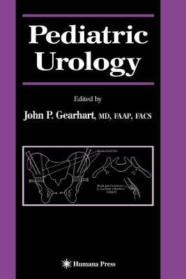 Pediatric Urology(English, Paperback, unknown)